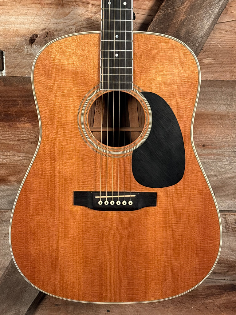 1993 Martin D-35 – Starr's Guitars