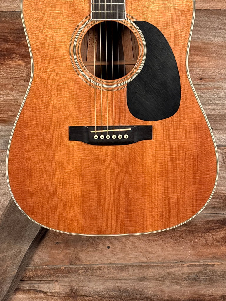 1993 Martin D-35 – Starr's Guitars